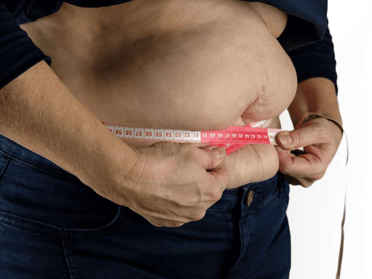 Obesity on rise among rural families in Telangana: ICRISAT study