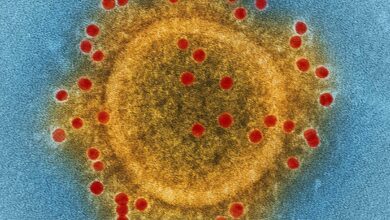 28-year-old man tests positive for MERS-CoV in Abu Dhabi