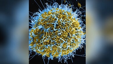 Microscopic view of a virus particle with yellow and blue structures.