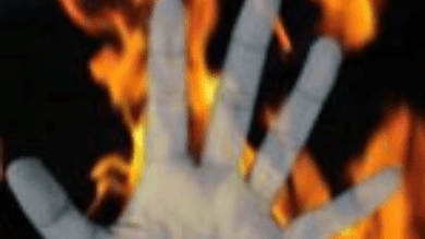 Newly-married woman found with burn injuries on highway in UP
