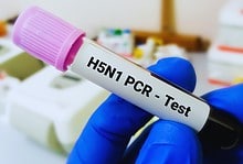 Australia reports first human case of H5N1 bird flu