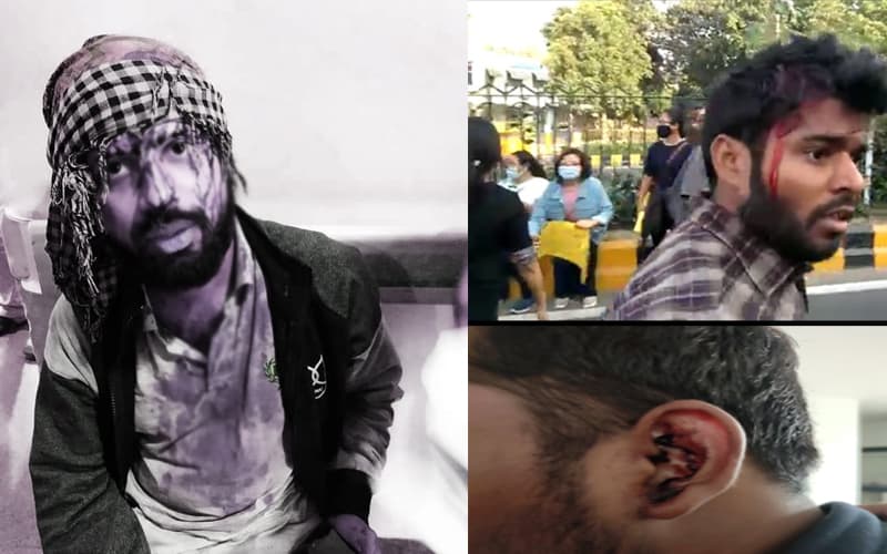 JNU protests: Students alleged assault, police says otherwise