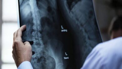 Why spinal cord injury linked to higher rates of stroke?