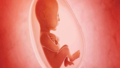 Abortion