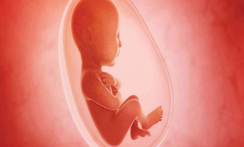 Abortion