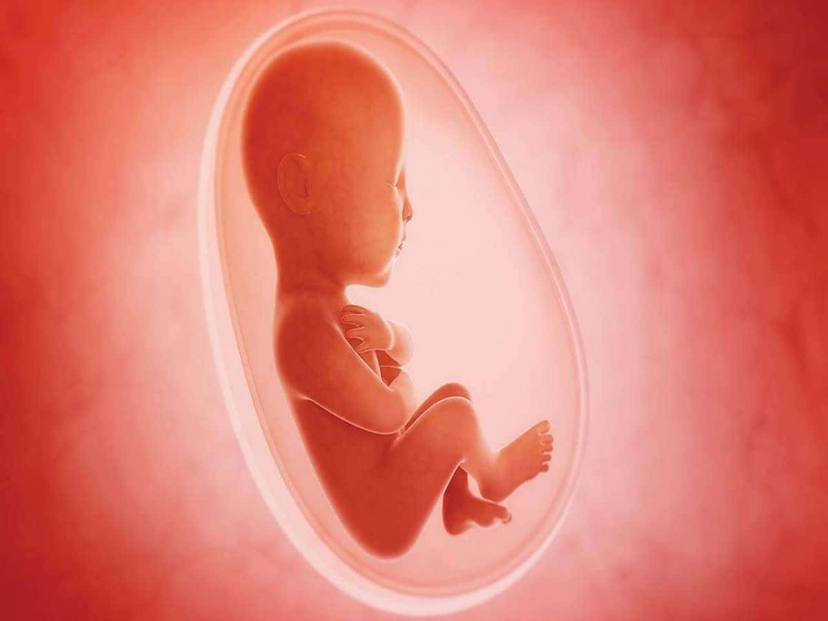 Abortion