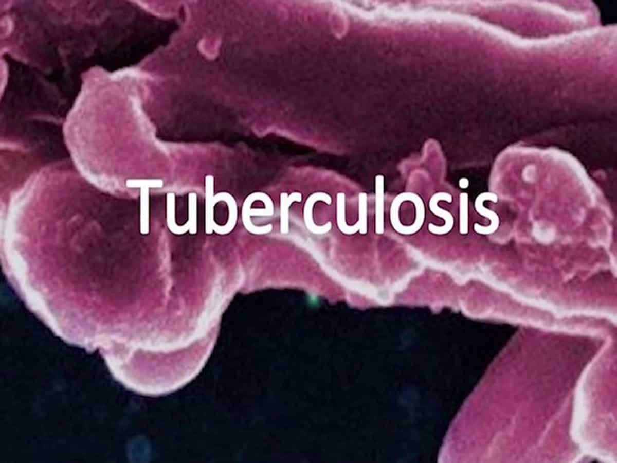 With 664 so far, Telangana sees drop in TB deaths in 2024