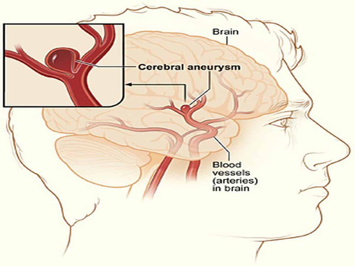 Brain