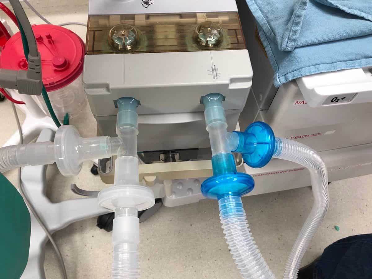 Hyderabad engineers develop Rs 4000 portable ventilator