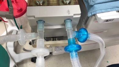 Ventilator