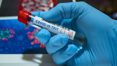Covid-19 test sample