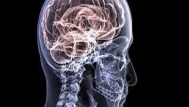 Neurological emergencies should not be delayed: Neurologist