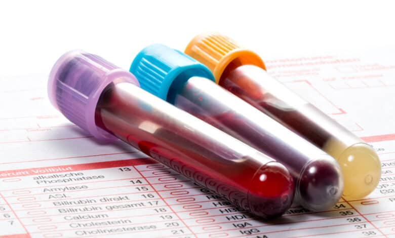 Six kids test HIV positive in MP hospitals