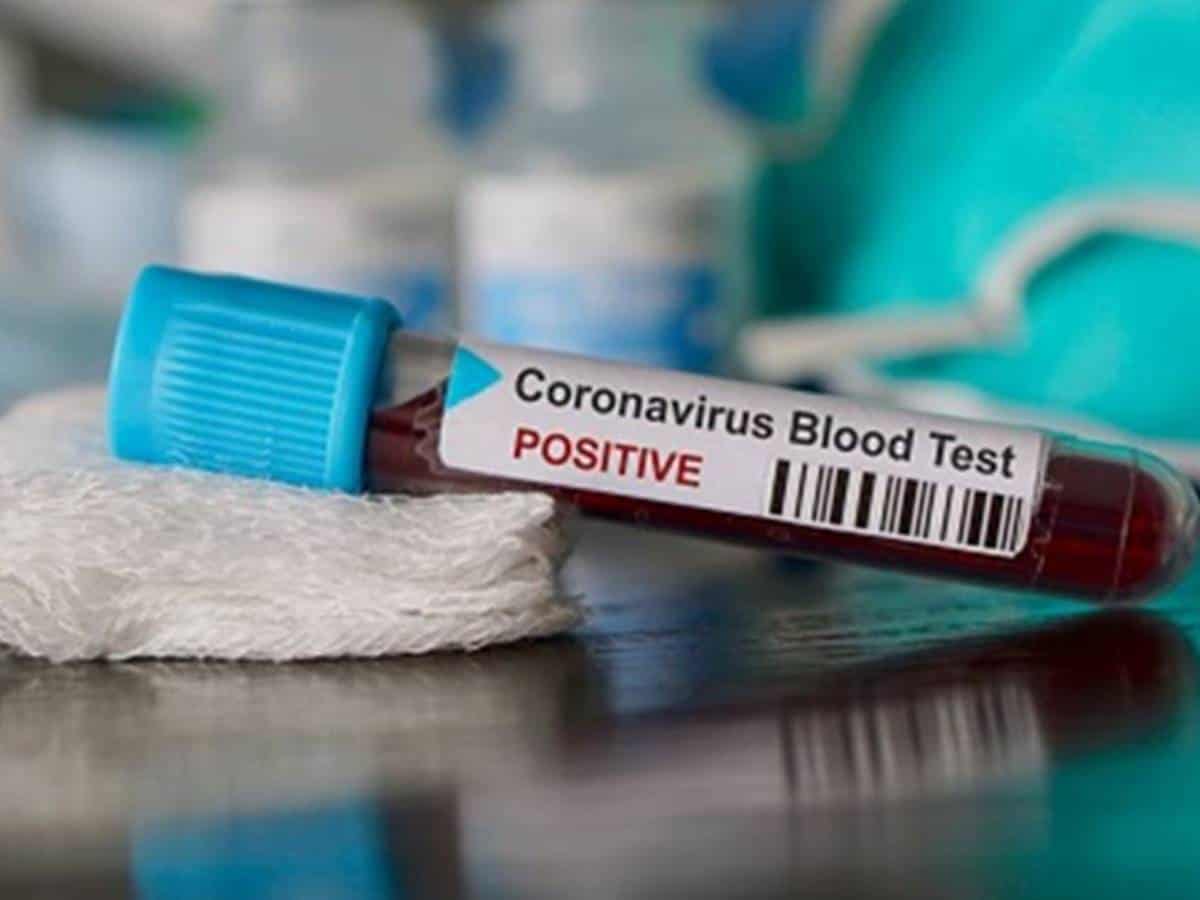 Madhya Pradesh Cooperative Minister tests Covid-19 positive