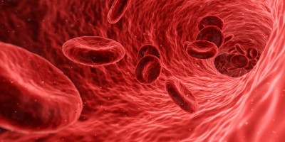 Blood test may point to patients at higher risk for Covid-19 death