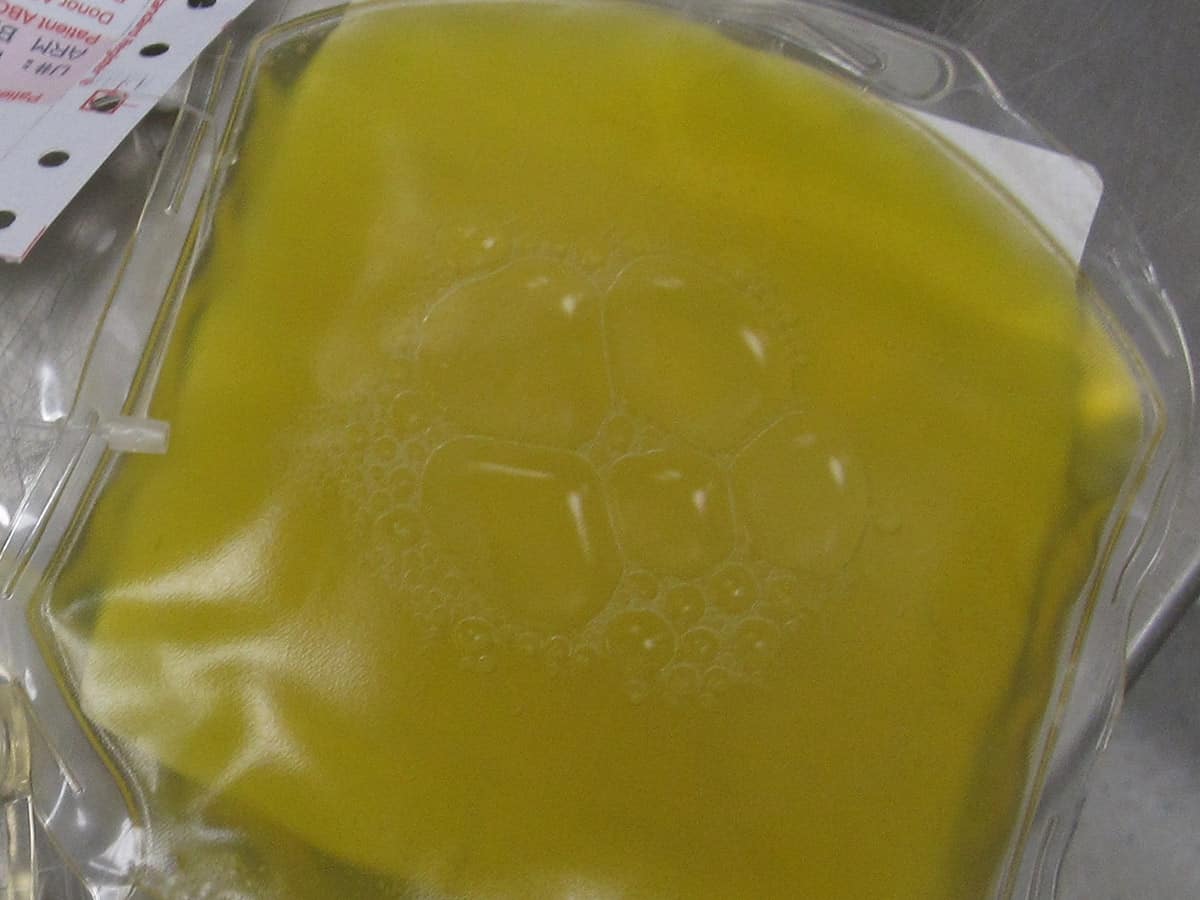 Plasma therapy safe and effective for Covid patients: Study