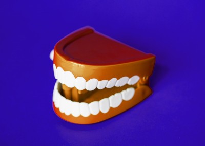 Binging on junk; unavailability of dental services affecting oral health