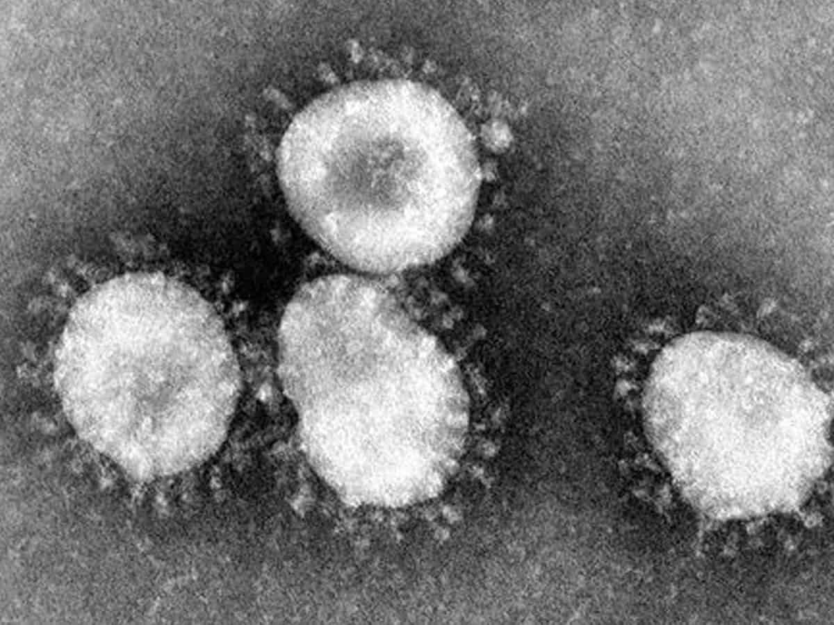 Meghalaya reports 73 new COVID cases, two more deaths