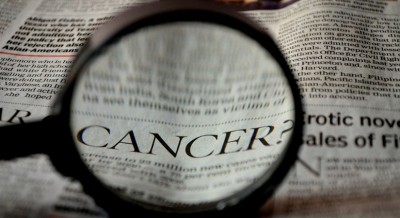 Covid effect: Cancer patients who delay treatment are at a great risk