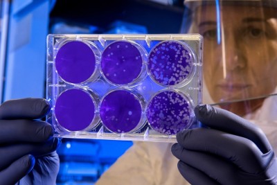 Eating turkey, probiotics may treat people with celiac disease