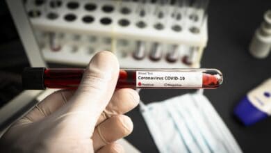 Hand in gloves holds a test tube containing a blood sample test tube for Covid-19 analyzing