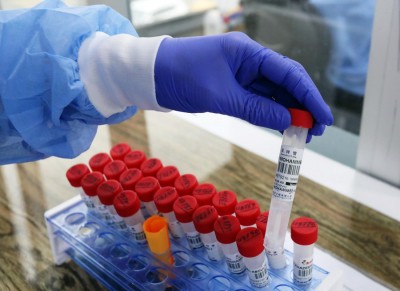 Africa's Covid-19 cases cross 2.4 mn