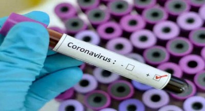 Two held for giving false Covid test reports in Gurugram