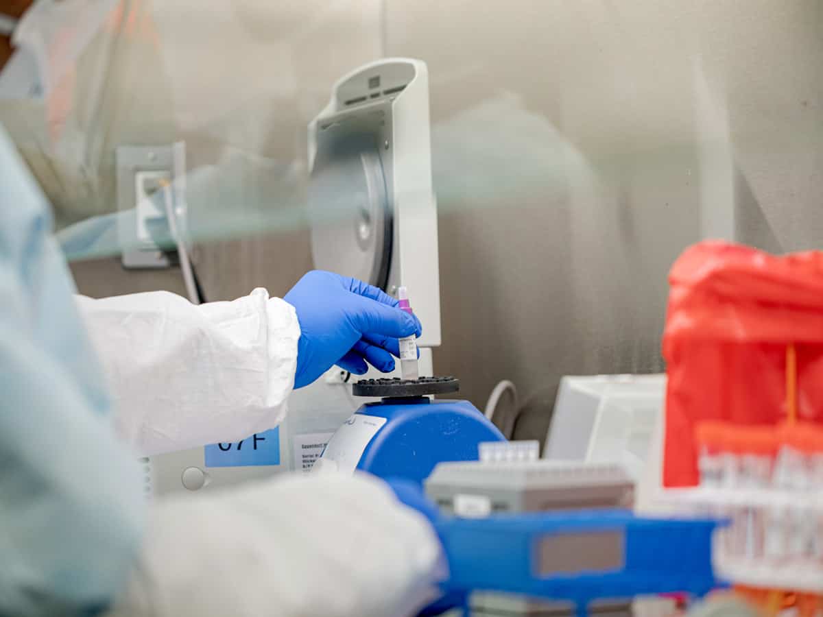 29 cases of 'scrub typhus' in Mathura, alert sounded