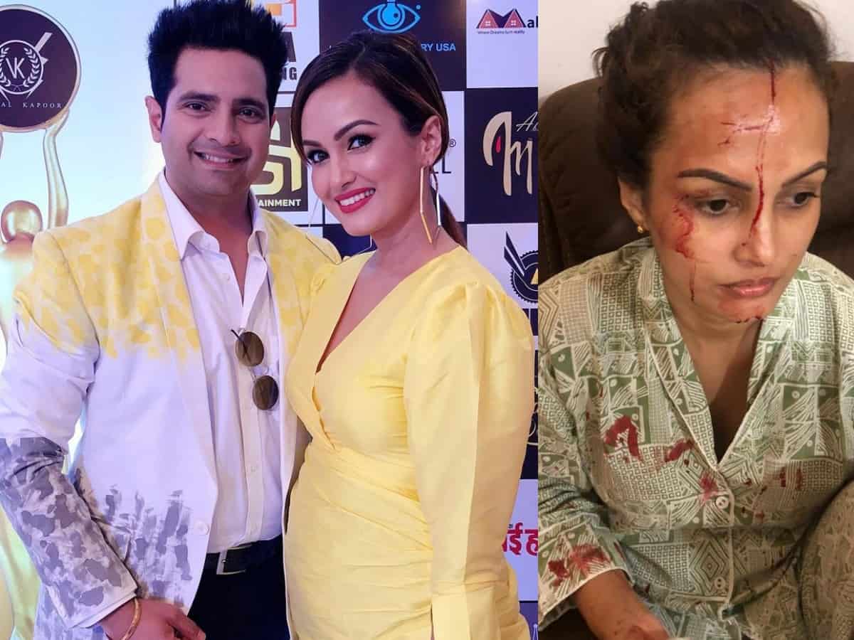 Nisha Rawal accuses Karan Mehra of having an affair, beating her