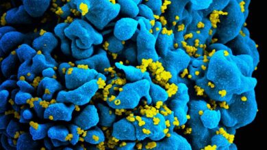 Scientists identify 2nd HIV patient whose body rid itself of virus