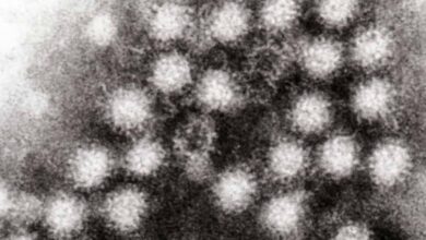 Norovirus