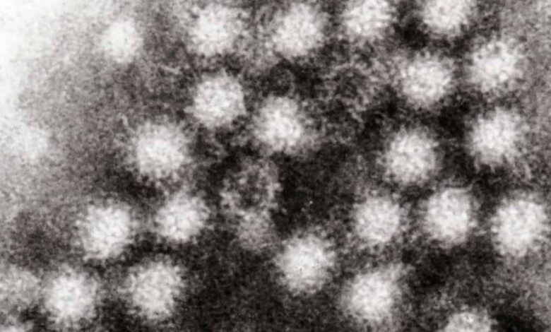 Norovirus
