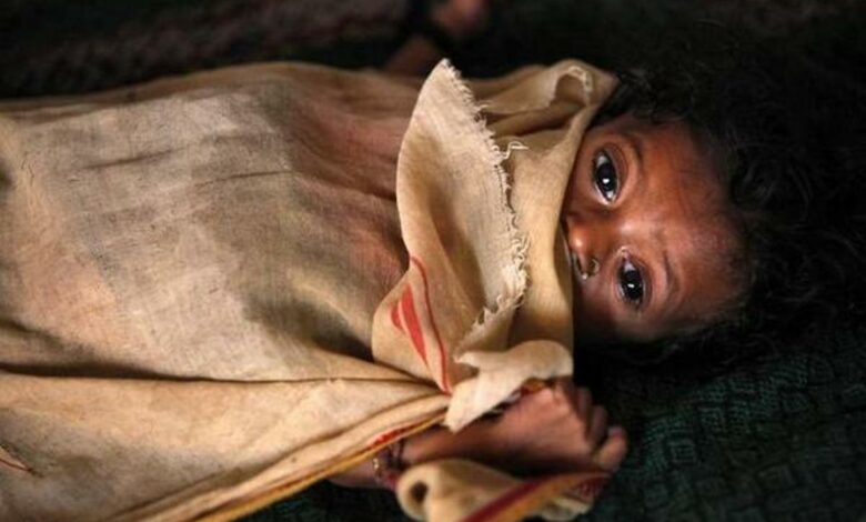malnutrition