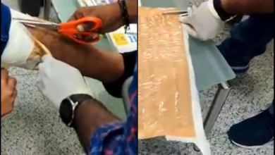 Gold paste concealed under bandage seized at Hyderabad airport