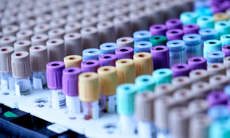 Toddler tests COVID positive at Niloufer Hospital in Hyderabad