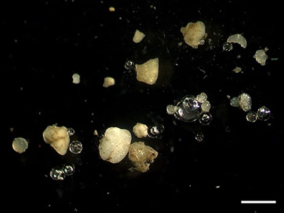 Scientists find microplastics in human blood for first time