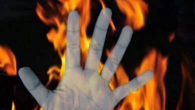 Class 10 student set ablaze by unidentified persons in Andhra