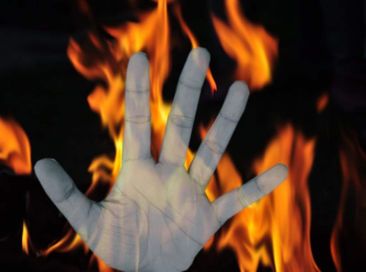 Class 10 student set ablaze by unidentified persons in Andhra