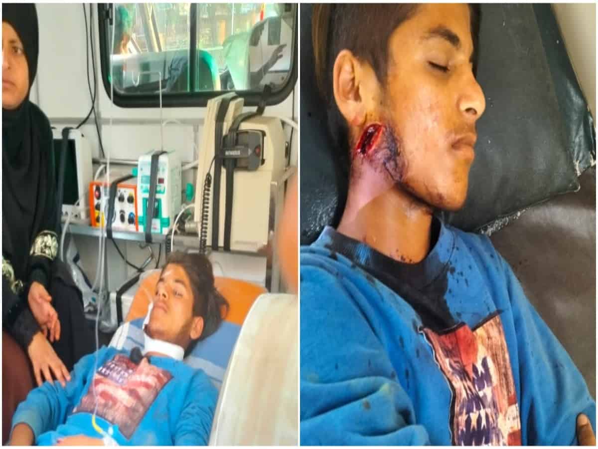 Karntaka: Hindutva goon attacks Muslim youth after watching The Kashmir files