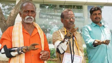 Hyderabad: Rotary District distributes free prosthetic hands to needy