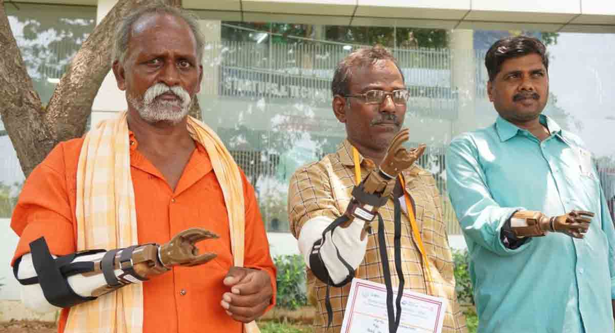 Hyderabad: Rotary District distributes free prosthetic hands to needy