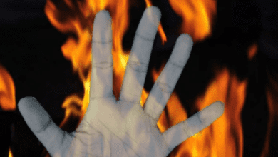 Telangana: Man sets nephews alight over property dispute