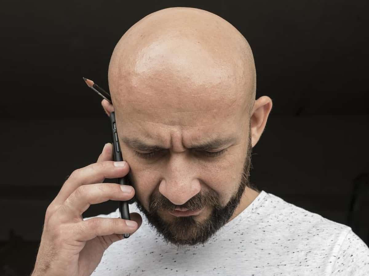 Calling man bald at work is sexual harassment, rules UK tribunal