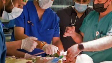 Saudi Arabia: Yemeni conjoined twin dies after 15-hour surgery