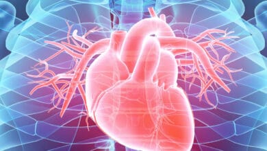 COVID-19 caused collateral damage to global cardiac services: Study