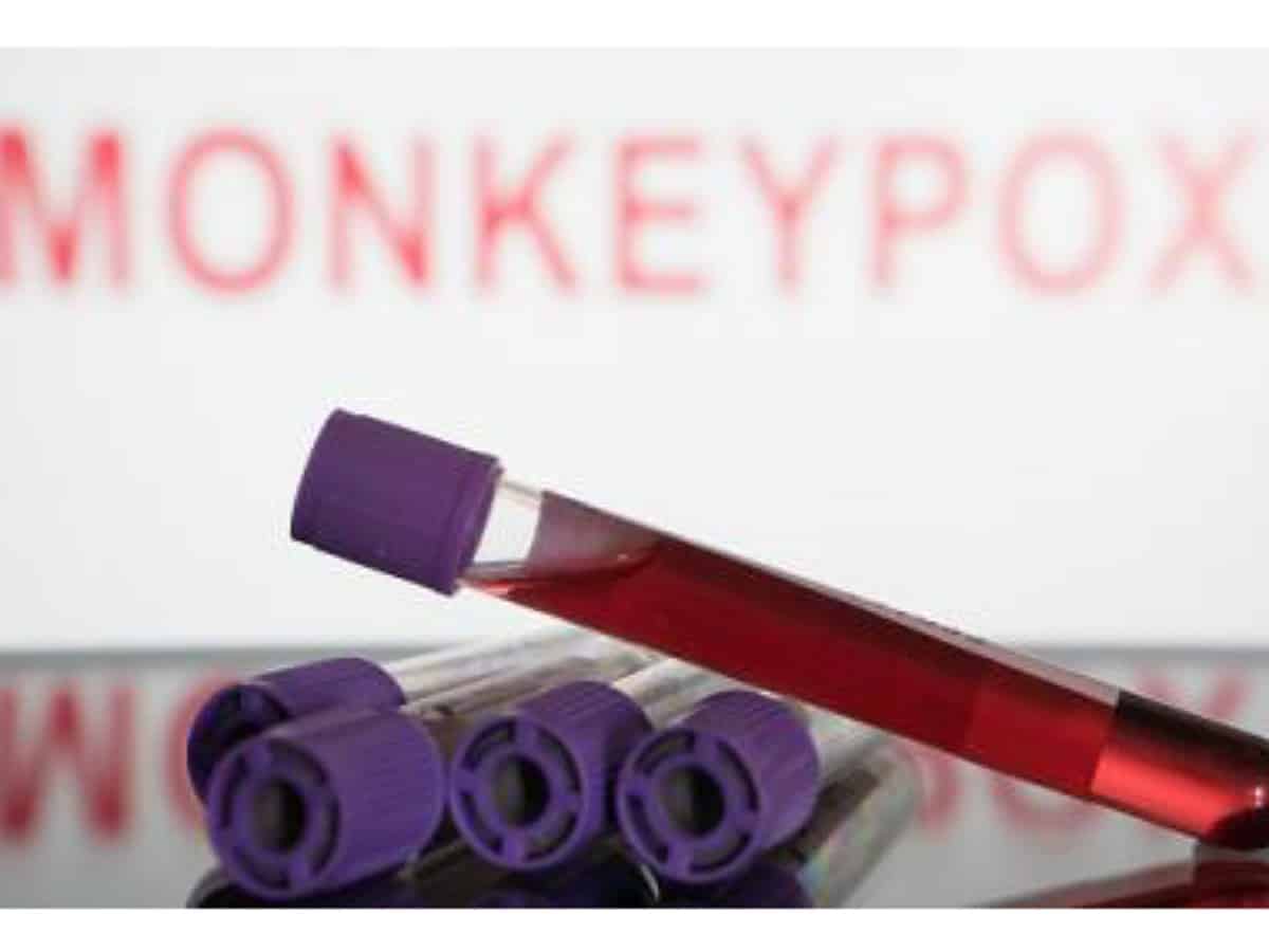 Canada confirms 1,435 monkeypox cases