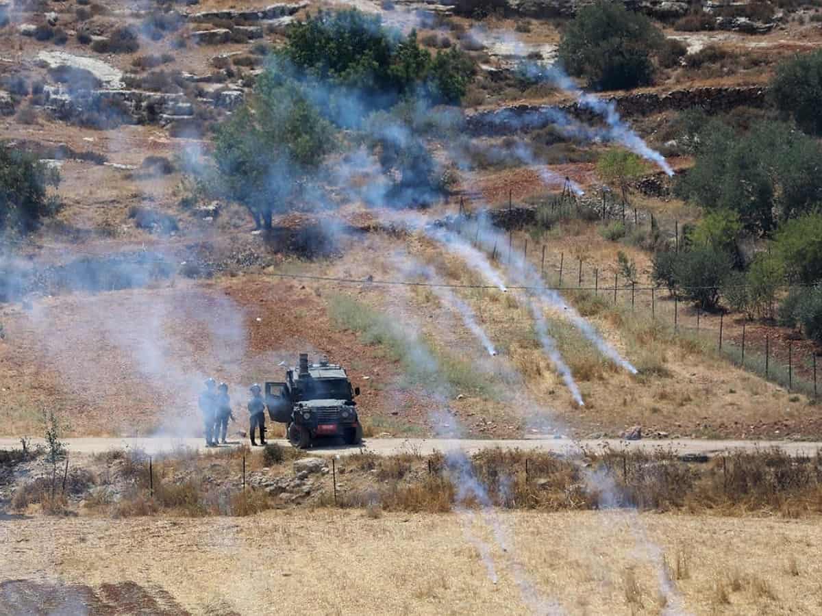 131 Palestinians injured in Israeli attack in West Bank