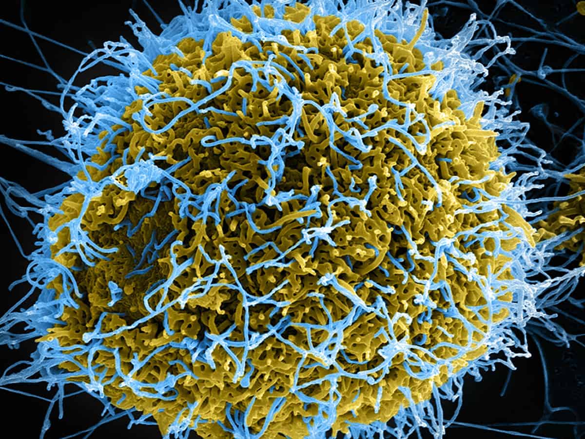 The Marburg virus: urgent need to contain this close cousin of Ebola