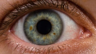 'Step therapy' effective strategy for diabetic eye disease: Study