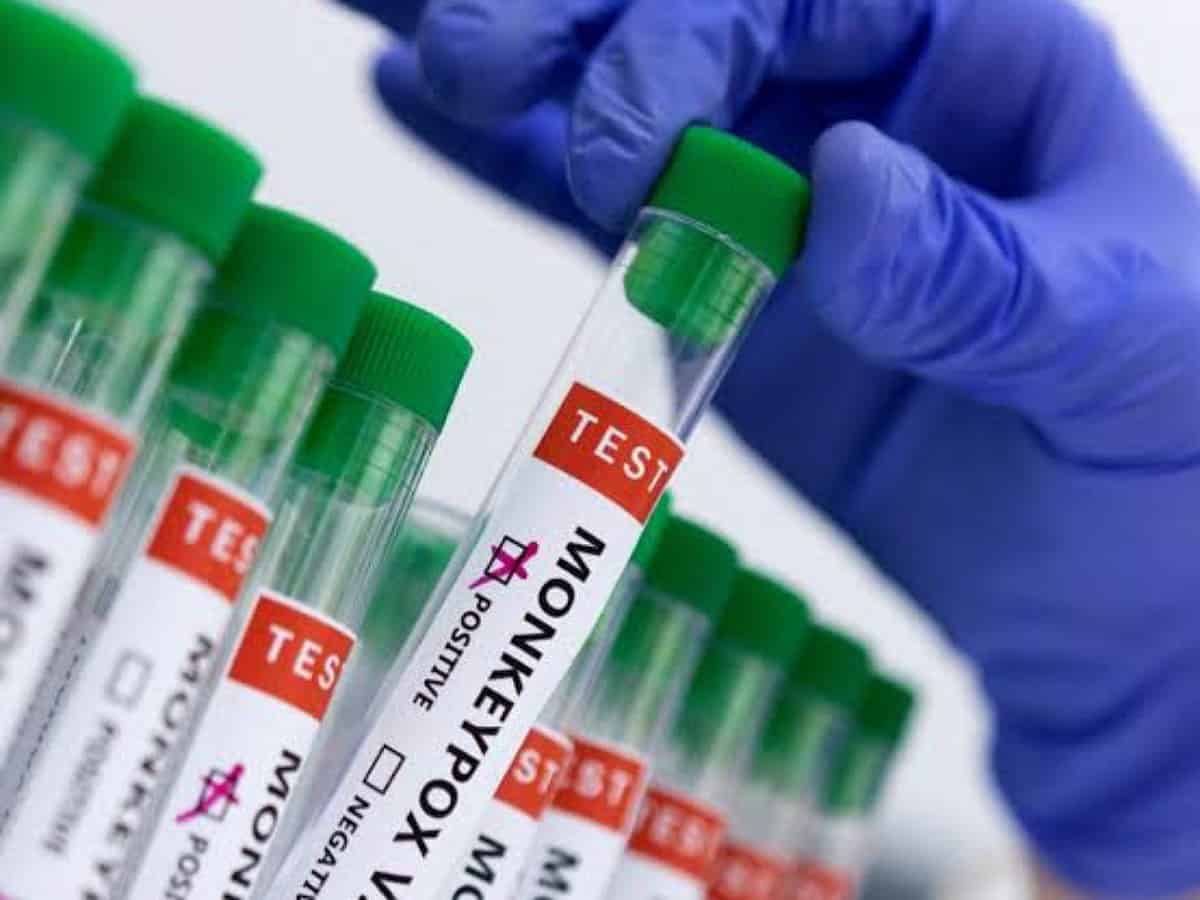 One contact of Delhi monkeypox patient has complained of body ache, being monitored: Sources